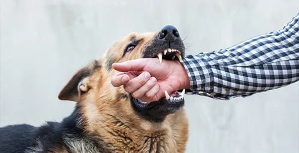 Dog Bite Injury